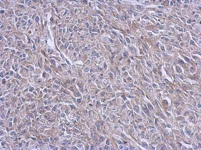 Immunohistochemistry-Paraffin: FARSB Antibody [NBP2-16430]