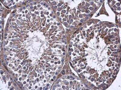 Immunohistochemistry-Paraffin: FARSB Antibody [NBP2-16430]