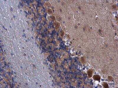Immunohistochemistry-Paraffin: FARSB Antibody [NBP2-16430]