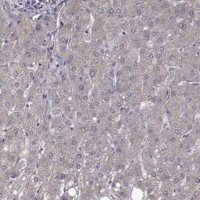 Immunohistochemistry-Paraffin: FARSB Antibody [NBP2-38917]