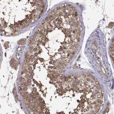 Immunohistochemistry-Paraffin: FARSB Antibody [NBP2-38917]