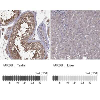 Immunohistochemistry-Paraffin: FARSB Antibody [NBP2-38917]