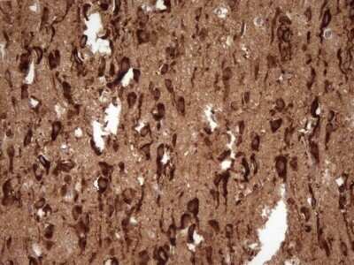Immunohistochemistry: FARSB Antibody (OTI4B3) - Azide and BSA Free [NBP2-71539]