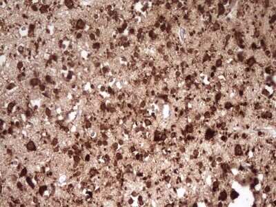 Immunohistochemistry: FARSB Antibody (OTI4B3) - Azide and BSA Free [NBP2-71539]