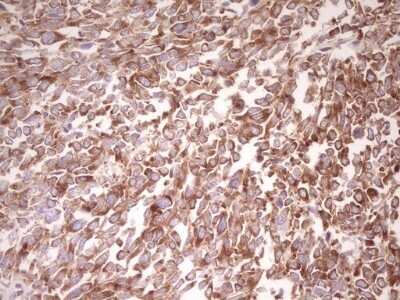 Immunohistochemistry: FARSB Antibody (OTI4B3) - Azide and BSA Free [NBP2-71539]