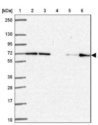 Western Blot: FARSB Antibody [NBP2-38917]