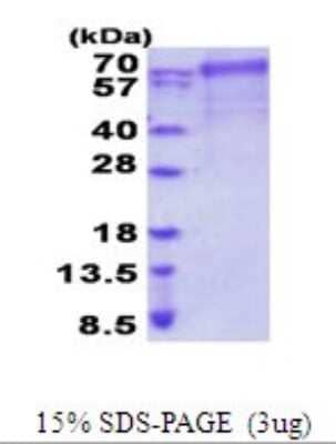 SDS-PAGE: Recombinant Human FARSB His Protein [NBP2-51968]