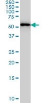 Western Blot: FARSLA Antibody (2D8) [H00002193-M01]