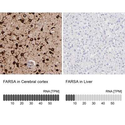 Immunohistochemistry-Paraffin: FARSLA Antibody [NBP1-88067]