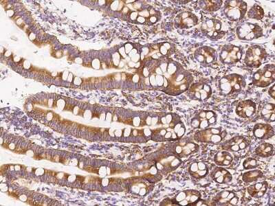 Immunohistochemistry-Paraffin: FARSLA Antibody [NBP2-97761]