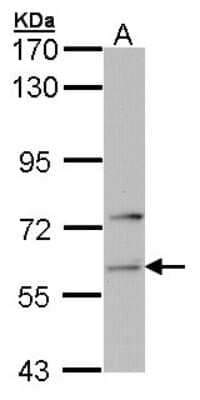 Western Blot: FARSLA Antibody [NBP1-33308]