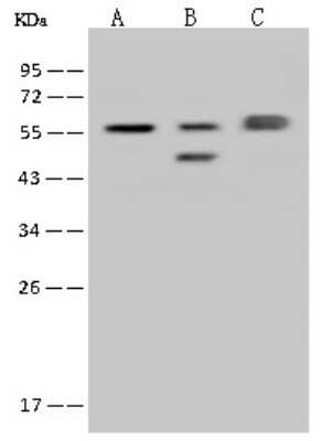 Western Blot: FARSLA Antibody [NBP2-97761]