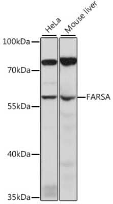 Western Blot: FARSLA AntibodyAzide and BSA Free [NBP3-03569]