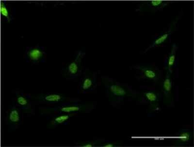 Immunocytochemistry/ Immunofluorescence: FASTK Antibody (2B7) [H00010922-M02]