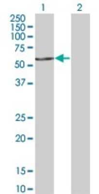 Western Blot: FASTK Antibody (2B7) [H00010922-M02]