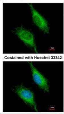 Immunocytochemistry/ Immunofluorescence: FASTK Antibody [NBP1-31323]