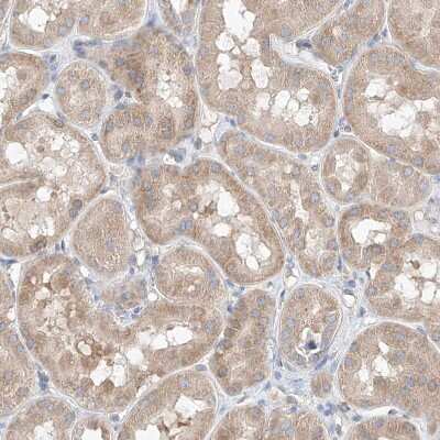 Immunohistochemistry-Paraffin: FASTK Antibody [NBP1-84729]