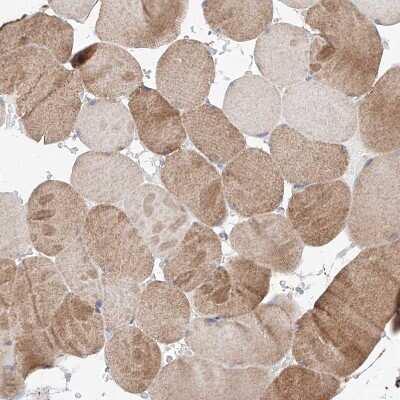 Immunohistochemistry-Paraffin: FASTK Antibody [NBP1-84729]