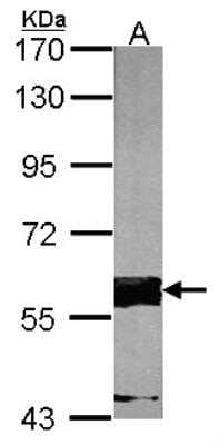 Western Blot: FASTK Antibody [NBP1-31323]