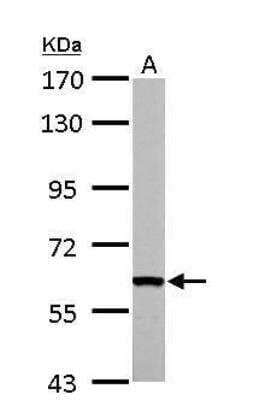 Western Blot: FASTK Antibody [NBP1-31323]