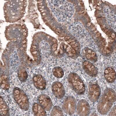 Immunohistochemistry-Paraffin: FASTKD1 Antibody [NBP2-14009]