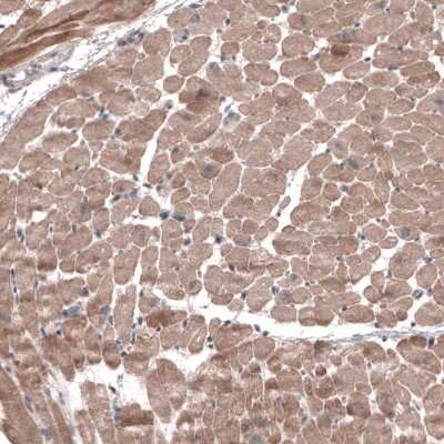 Immunohistochemistry-Paraffin: FASTKD1 Antibody [NBP2-14009]