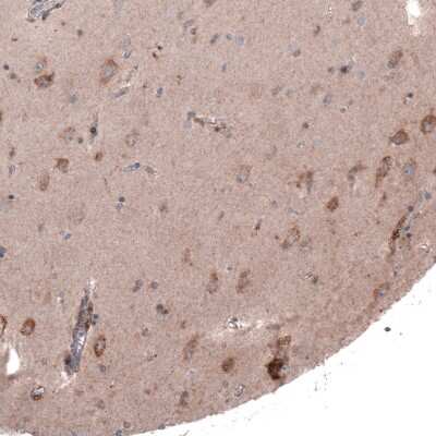 Immunohistochemistry-Paraffin: FASTKD1 Antibody [NBP2-14009]