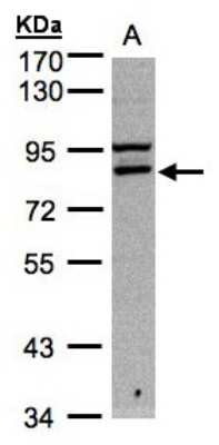 Western Blot: FASTKD1 Antibody [NBP1-32639]