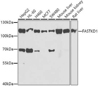 Western Blot: FASTKD1 AntibodyBSA Free [NBP3-05137]