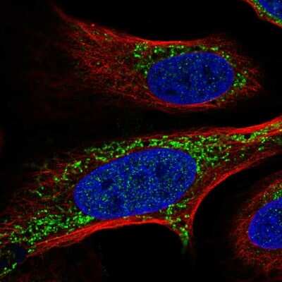 Immunocytochemistry/ Immunofluorescence: FASTKD2 Antibody [NBP2-57917]