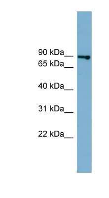 Western Blot: FASTKD2 Antibody [NBP1-55360]