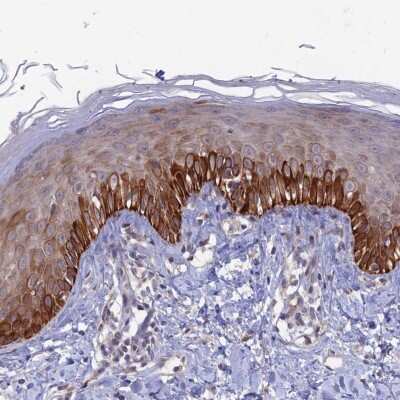 Immunohistochemistry-Paraffin: FASTKD5 Antibody [NBP1-91888]