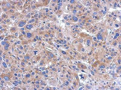 Immunohistochemistry-Paraffin: FASTKD5 Antibody [NBP2-16435]