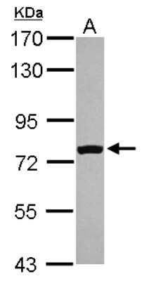 Western Blot: FASTKD5 Antibody [NBP2-16435]