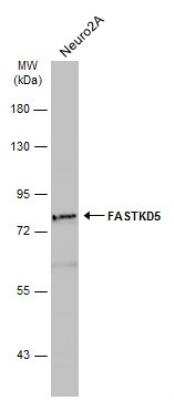 Western Blot: FASTKD5 Antibody [NBP2-16435]