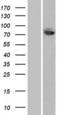 Western Blot: FASTKD5 Overexpression Lysate [NBP2-06516]