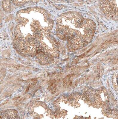 Immunohistochemistry-Paraffin: FAT1 Antibody [NBP1-84565]