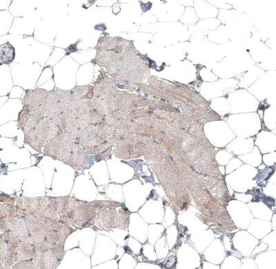 Immunohistochemistry-Paraffin: FAT1 Antibody [NBP1-84565]
