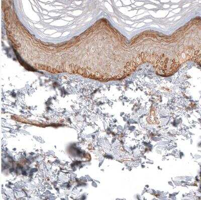 Immunohistochemistry-Paraffin: FAT1 Antibody [NBP1-84565]