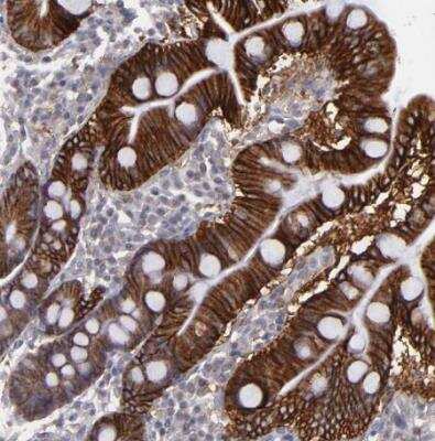 Immunohistochemistry-Paraffin: FAT1 Antibody [NBP1-84566]