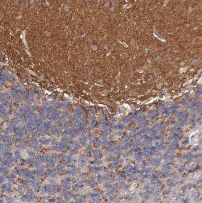 Immunohistochemistry-Paraffin: FAT1 Antibody [NBP1-84566]