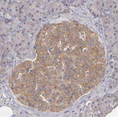 Immunohistochemistry-Paraffin: FAT1 Antibody [NBP1-84566]