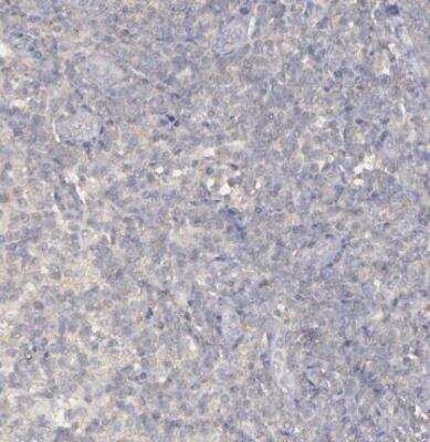 Immunohistochemistry-Paraffin: FAT1 Antibody [NBP1-84566]