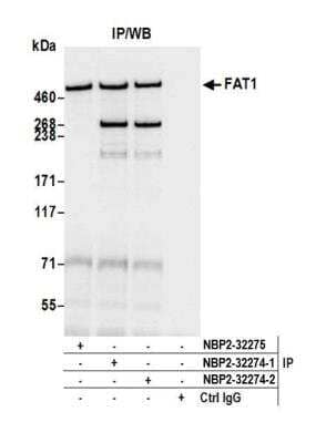 Immunoprecipitation: FAT1 Antibody [NBP2-32274]