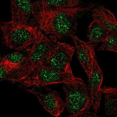 Immunocytochemistry/ Immunofluorescence: FAT10 Antibody [NBP2-13498]