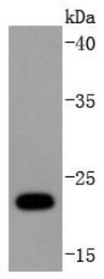 Western Blot: FAT10 Antibody (JJ084-09) [NBP2-67917]