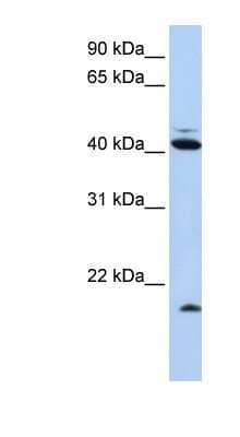 Western Blot: FAT10 Antibody [NBP1-58337]