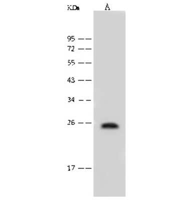 Western Blot: FAT10 Antibody [NBP2-99524]