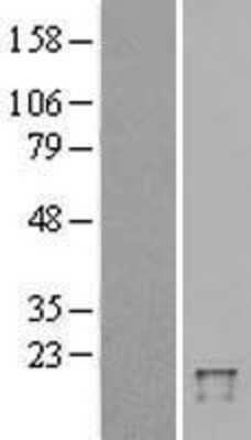 Western Blot: FAT10 Overexpression Lysate [NBL1-17510]