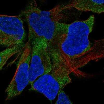 Immunocytochemistry/ Immunofluorescence: FAT4 Antibody [NBP2-49064]